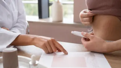 Tretinoin: Effektiv bei Dehnungsstreifen in der aktiven Phase 16 Dermatologische Beratung zur Anwendung einer Creme bei frühen Dehnungsstreifen