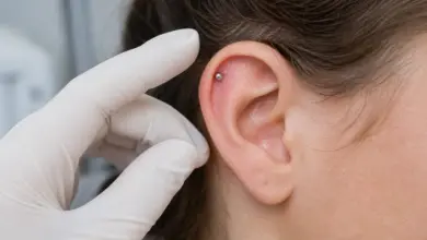 Wildfleisch am Piercing - Wie damit umgehen? 2 Kleine Reizung an einem Helix-Piercing