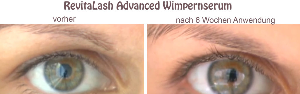 RevitaLash Wimpernserum vorher nachher